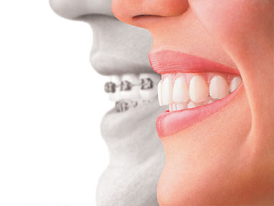 The image features a split-screen comparison between a person s natural teeth and an alternative, likely dental implants or veneers, with a focus on oral health and cosmetic dentistry.