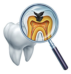 Alt text  An illustration showing an open human mouth with teeth and gums, viewed through a magnifying glass, revealing the internal structure of a tooth with roots and pulp, and a dental implant in place of a missing tooth, set against a white background.