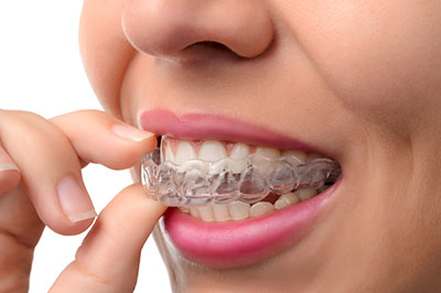 The image shows a person with a smile, holding a toothbrush with braces on it, against a white background.