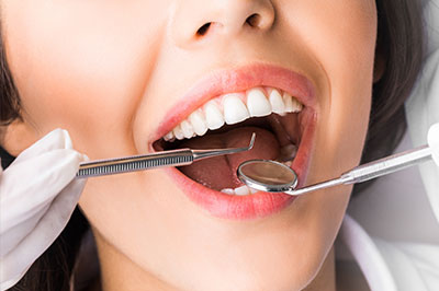 A woman s mouth being prepared for dental work, with tools and a dentist s hand visible.