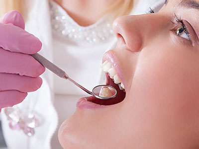 A dental professional performing a dental procedure on a patient s mouth.